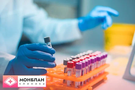 Врач исследует результаты анализа на наркотики